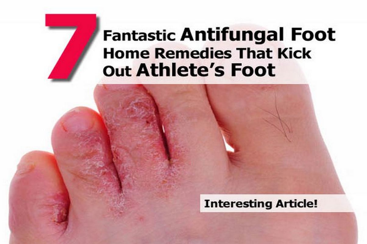7 Fantastic Antifungal Foot Home Remedies That Kick Out Athlete’s Foot