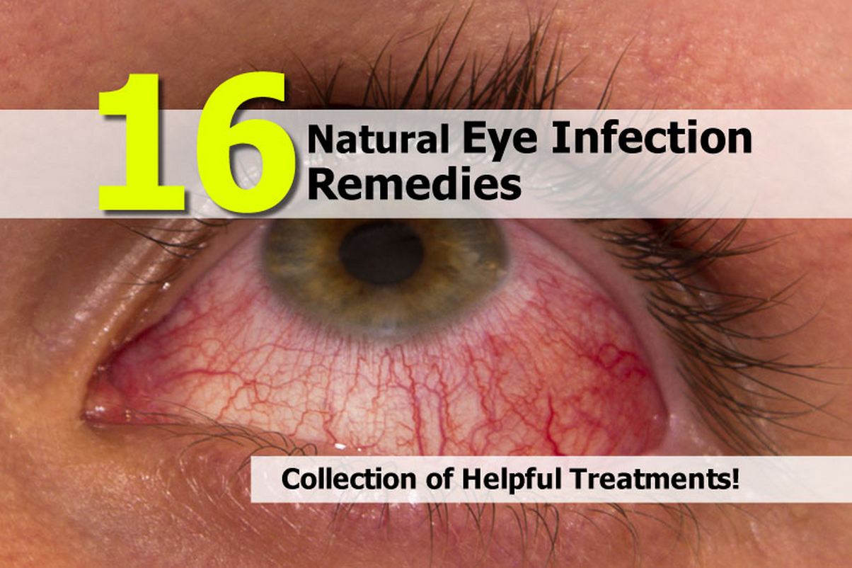 16-natural-eye-infection-remedies