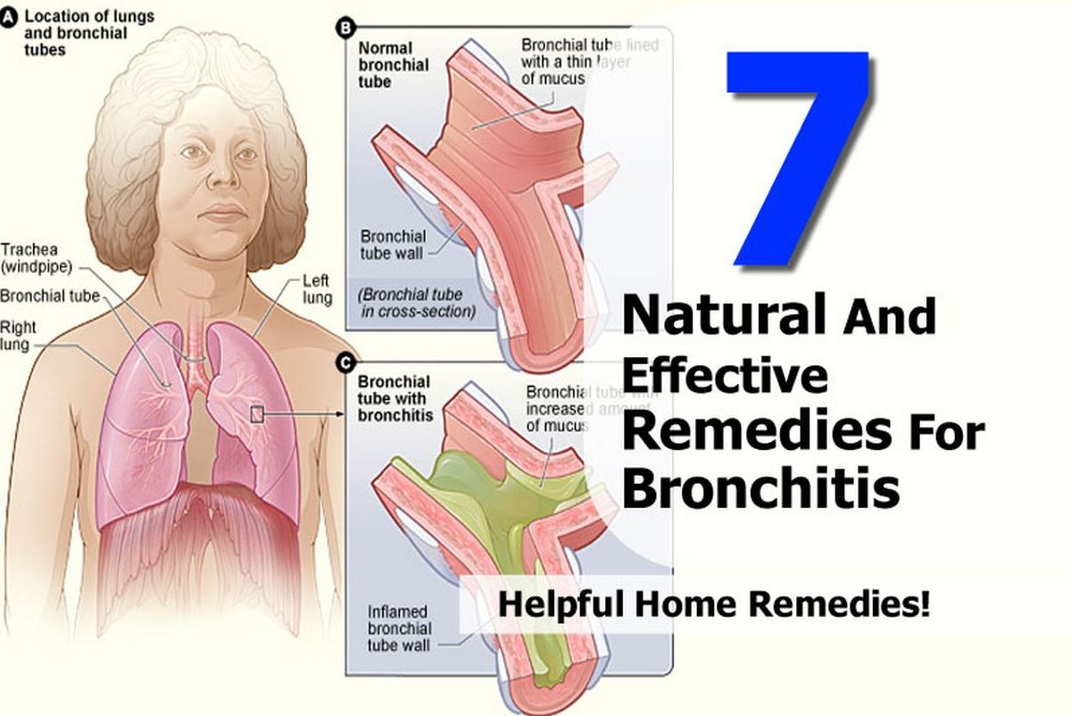 Natural Food For Bronchitis Natural Food For Bronchitis