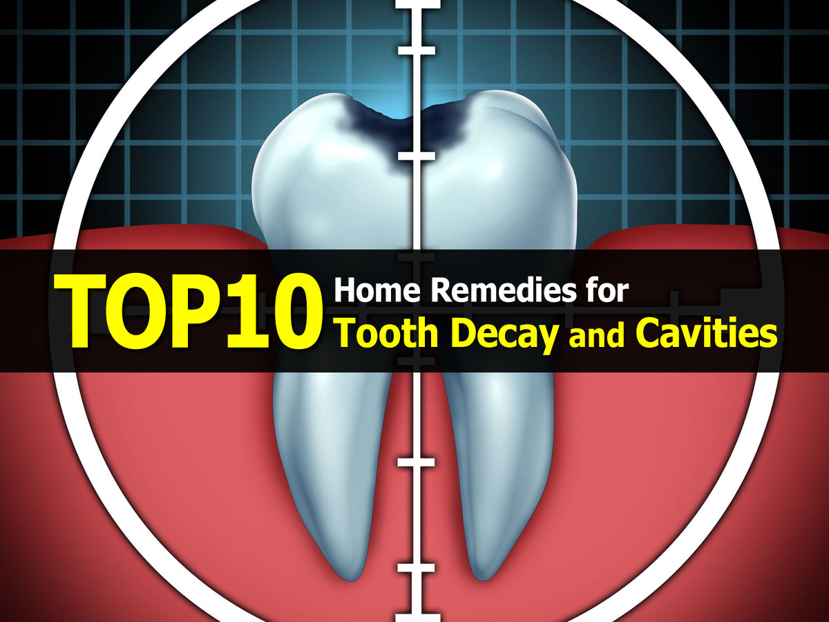 Top 10 Home Remedies for Tooth Decay and Cavities