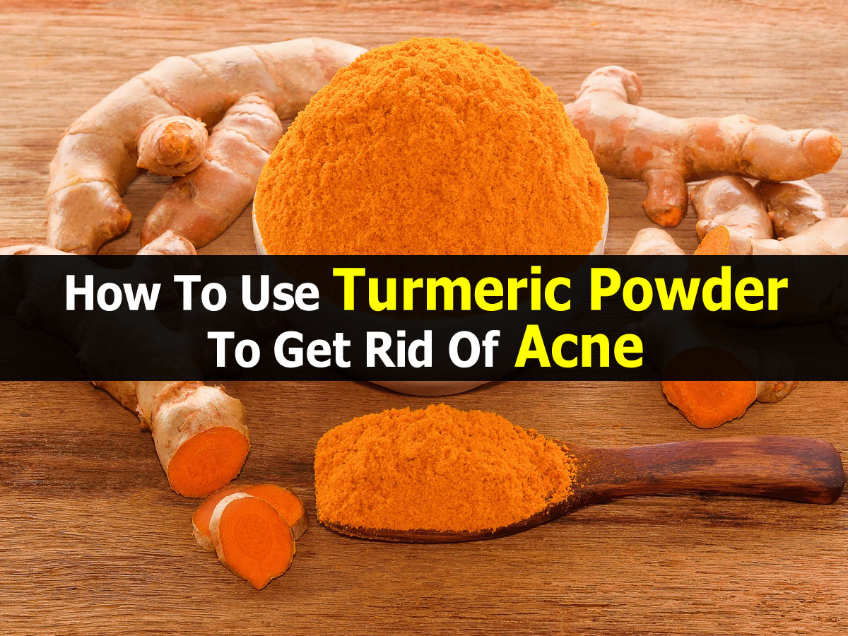 How To Use Turmeric Powder To Get Rid Of Acne