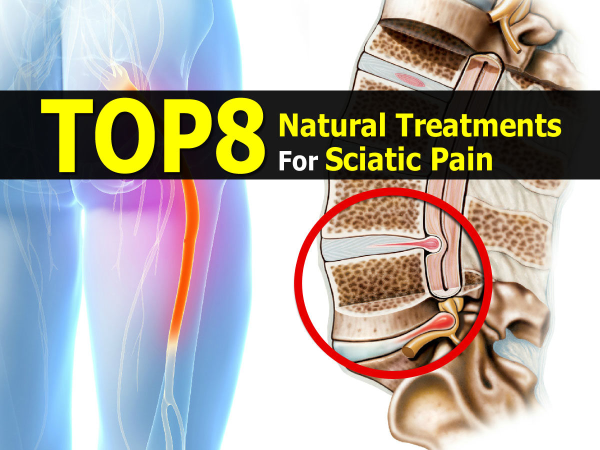 Top 8 Natural Treatments For Sciatic Pain Top 8 Natural Treatments For Sciatic Pain